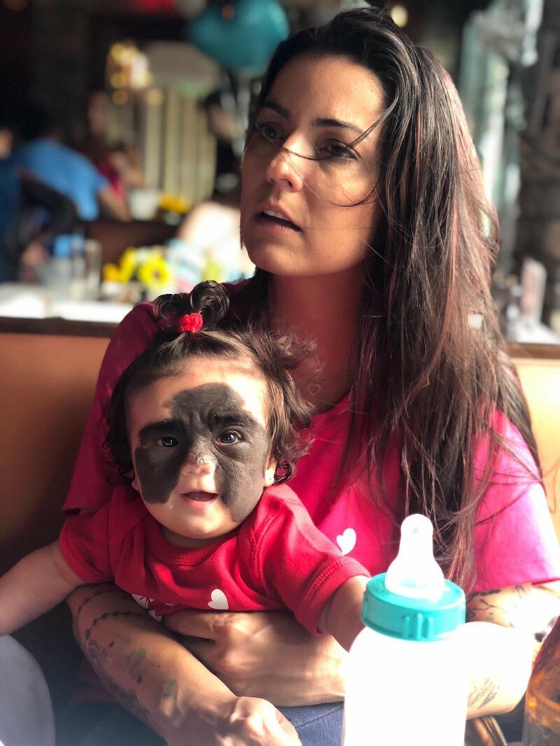 Маленькая американка с родимым пятном в виде «маски Бэтмена» едет лечиться в Россию (6 фото) Маленькая американка с родимым пятном в виде «маски Бэтмена» едет лечиться в Россию (6 фото)