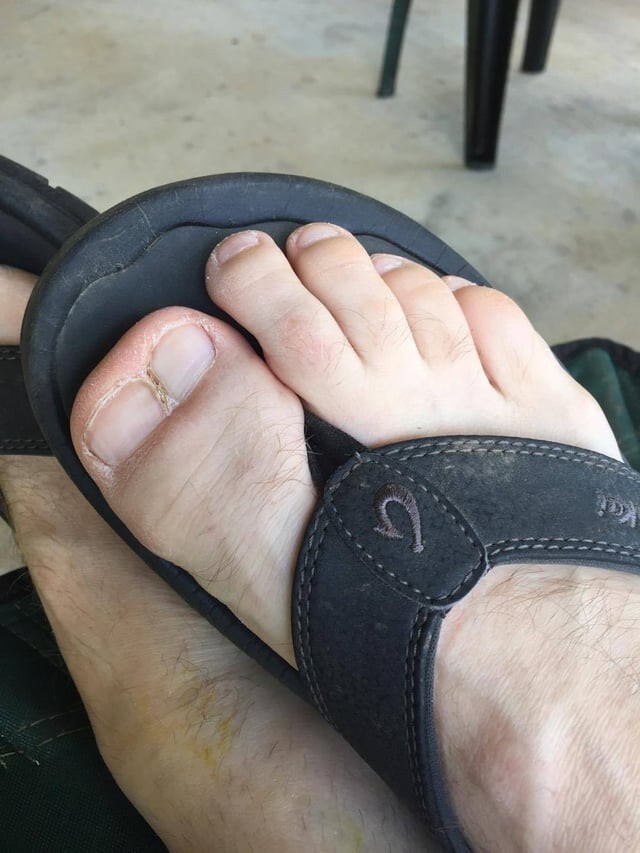 Странности и аномалии человеческого тела, от которых просто глаза лезут на лоб (24 фото) Странности и аномалии человеческого тела, от которых просто глаза лезут на лоб (24 фото)