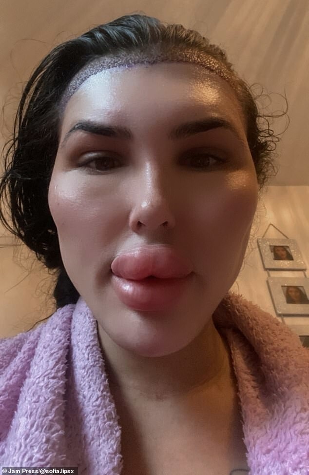 Британка хочет накачать губы так, чтобы обойти нынешнюю рекордсменку мира (10 фото + 1 видео) Британка хочет накачать губы так, чтобы обойти нынешнюю рекордсменку мира (10 фото + 1 видео)