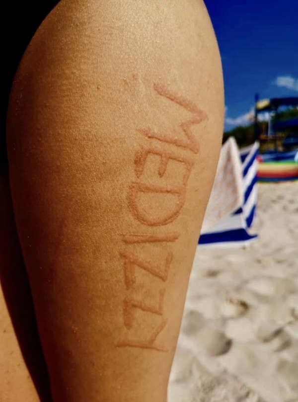 Странности и аномалии человеческого тела, от которых просто глаза лезут на лоб (24 фото) Странности и аномалии человеческого тела, от которых просто глаза лезут на лоб (24 фото)