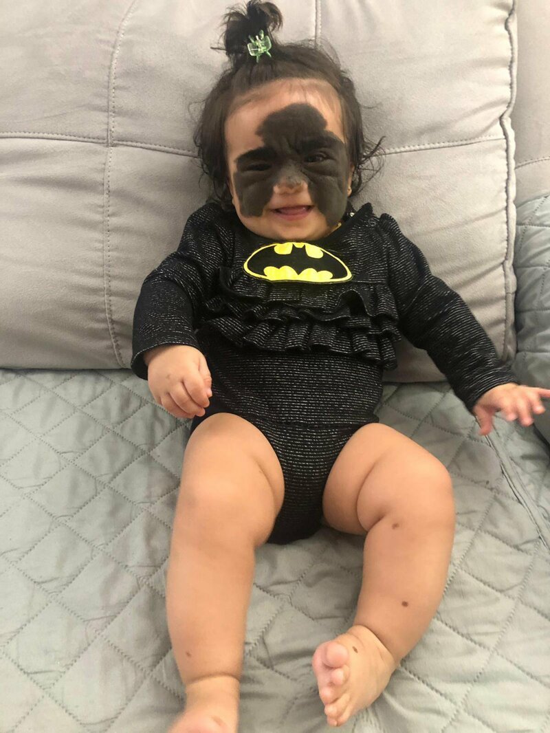 Маленькая американка с родимым пятном в виде «маски Бэтмена» едет лечиться в Россию (6 фото) Маленькая американка с родимым пятном в виде «маски Бэтмена» едет лечиться в Россию (6 фото)