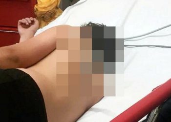 В Британии 12-летний мальчик получил весьма необычную травму, прыгая на батуте (4 фото) В Британии 12-летний мальчик получил весьма необычную травму, прыгая на батуте (4 фото)