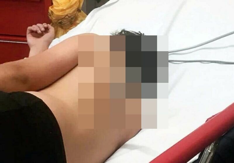 В Британии 12-летний мальчик получил весьма необычную травму, прыгая на батуте (4 фото)