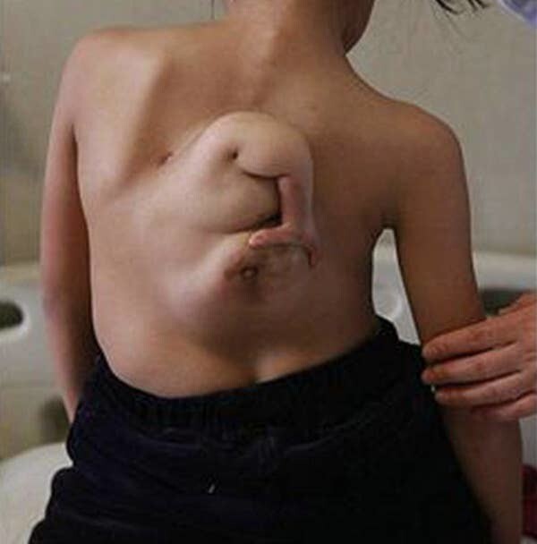 Странности и аномалии человеческого тела, от которых просто глаза лезут на лоб (24 фото)