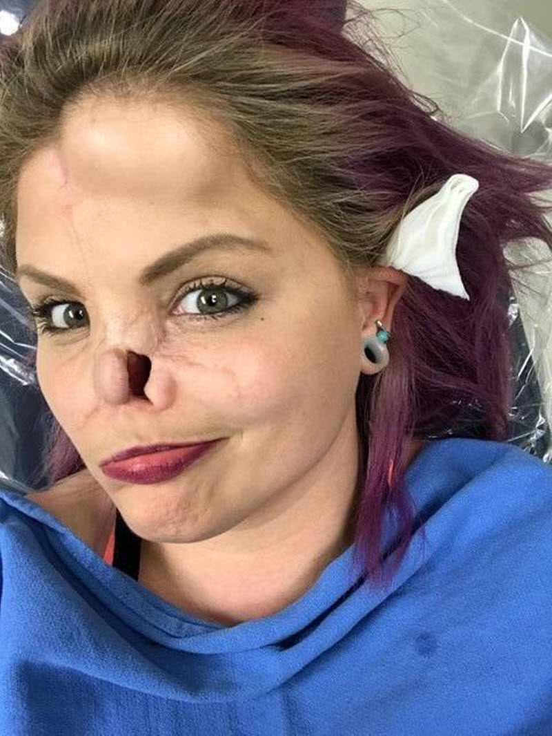 Изуродованная любовь (10 фото)