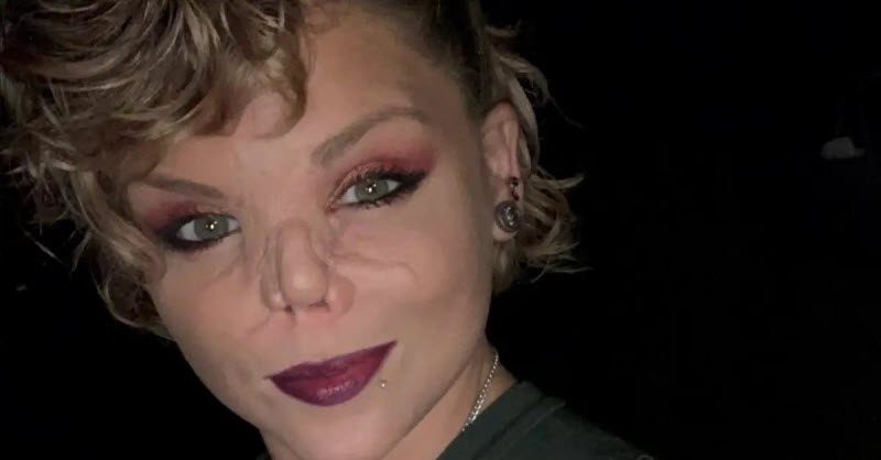 Изуродованная любовь (10 фото)