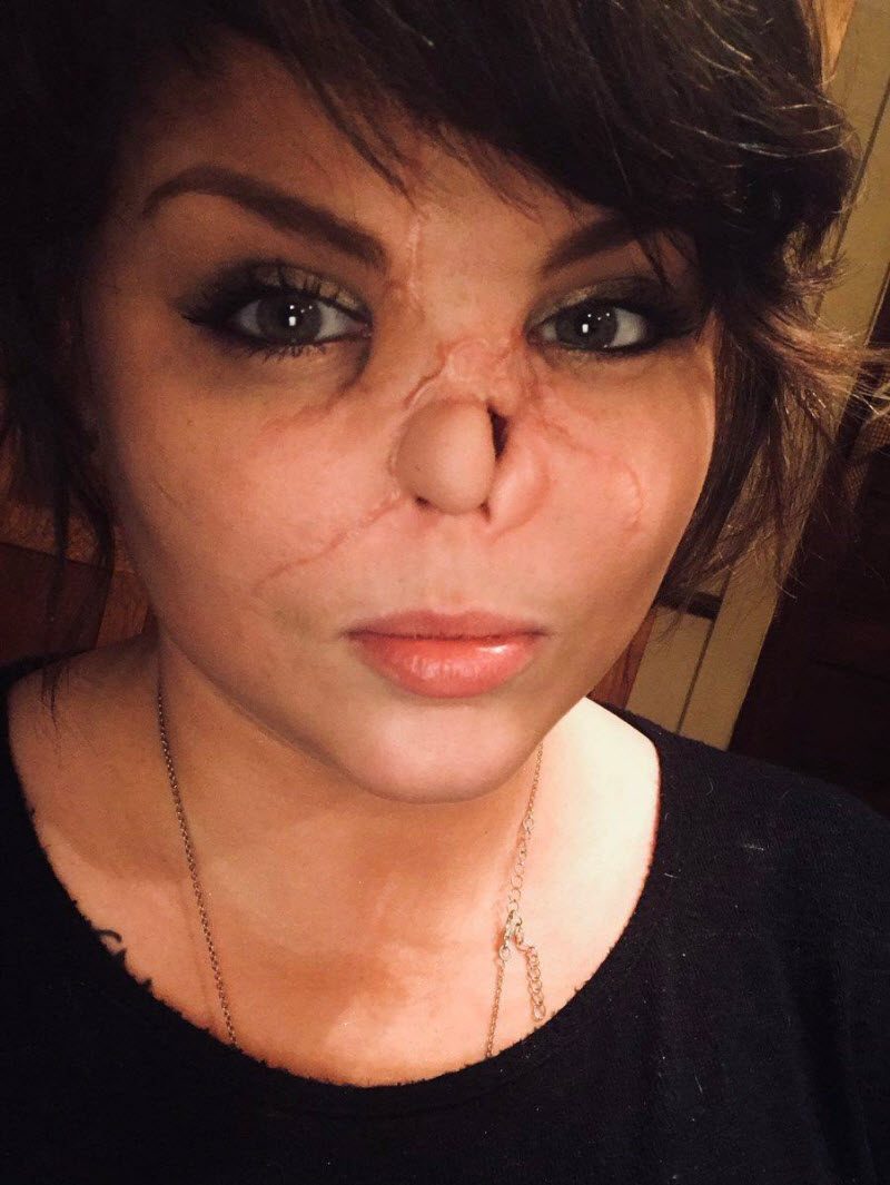 Изуродованная любовь (10 фото)