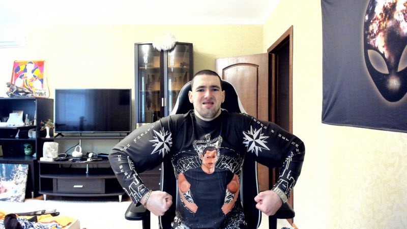 Врачи прооперировали Руки-Базуки, остались просто руки (3 фото)