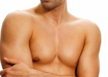 Лазерная эпиляция